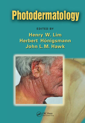 Lim / Honigsmann / Hawk | Photodermatology | Buch | 978-0-367-45319-0 | sack.de