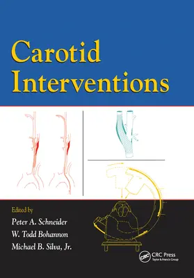 Schneider / Bohannon / Silva |  Carotid Interventions | Buch |  Sack Fachmedien