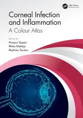 Mukhija / Tandon / Gupta |  Corneal Infection and Inflammation | Buch |  Sack Fachmedien
