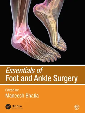 Bhatia |  Essentials of Foot and Ankle Surgery | Buch |  Sack Fachmedien