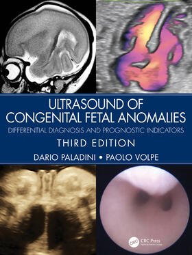 Paladini / Volpe | Ultrasound of Congenital Fetal Anomalies | Buch | 978-0-367-49950-1 | sack.de