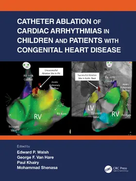Walsh / Khairy / Shenasa |  Catheter Ablation of Cardiac Arrhythmias in Children and Patients with Congenital Heart Disease | Buch |  Sack Fachmedien