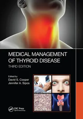 Cooper / Sipos |  Medical Management of Thyroid Disease, Third Edition | Buch |  Sack Fachmedien
