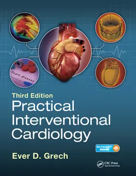 Grech |  Practical Interventional Cardiology | Buch |  Sack Fachmedien