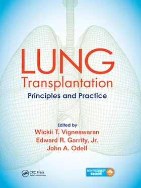 Vigneswaran / Garrity / Odell |  Lung Transplantation | Buch |  Sack Fachmedien