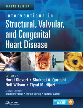 Sievert / Qureshi / Wilson |  Interventions in Structural, Valvular and Congenital Heart Disease | Buch |  Sack Fachmedien