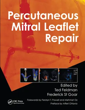 Feldman / St Goar |  Percutaneous Mitral Leaflet Repair | Buch |  Sack Fachmedien