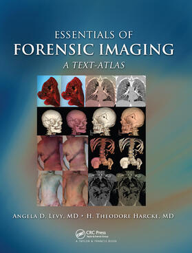 Levy / Harcke / Harcke Jr. | Essentials of Forensic Imaging | Buch | 978-0-367-57702-5 | sack.de