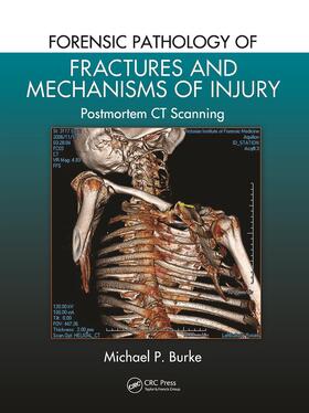 Burke | Forensic Pathology of Fractures and Mechanisms of Injury | Buch | 978-0-367-77819-4 | sack.de