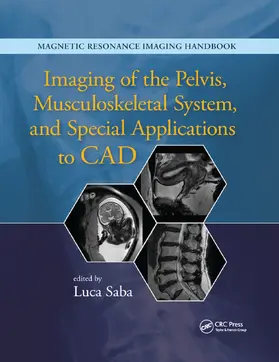 Saba |  Imaging of the Pelvis, Musculoskeletal System, and Special Applications to CAD | Buch |  Sack Fachmedien