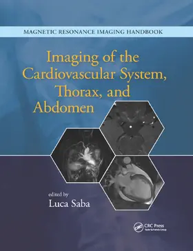 Saba | Imaging of the Cardiovascular System, Thorax, and Abdomen | Buch | 978-0-367-86891-8 | www.sack.de