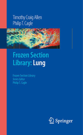 Allen / Cagle | Frozen Section Library: Lung | E-Book | sack.de