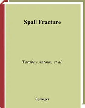 Antoun / Seaman / Curran |  Spall Fracture | eBook | Sack Fachmedien