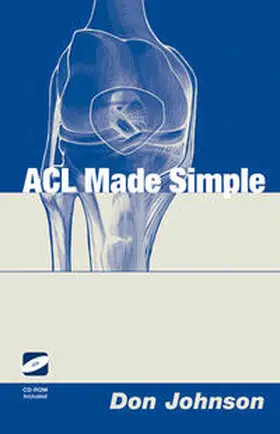 Johnson |  ACL Made Simple | eBook | Sack Fachmedien