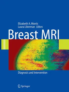 Liberman | Breast MRI | Buch | 978-0-387-21997-4 | www.sack.de