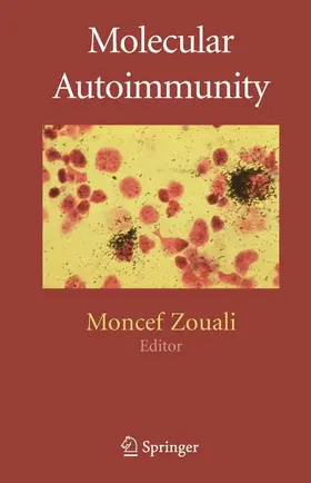 Zouali |  Molecular Autoimmunity | Buch |  Sack Fachmedien