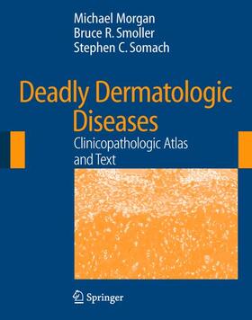 Morgan / Smoller / Somach | Deadly Dermatologic Diseases | Buch | 978-0-387-25442-5 | sack.de
