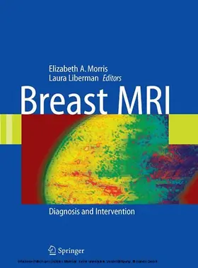 Liberman | Breast MRI | E-Book | www.sack.de