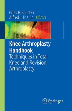 Scuderi / Tria |  Knee Arthroplasty Handbook | Buch |  Sack Fachmedien