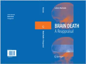 Machado |  Brain Death | eBook | Sack Fachmedien