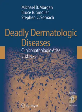 Morgan / Smoller / Somach |  Deadly Dermatologic Diseases | eBook | Sack Fachmedien