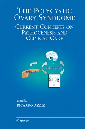 Azziz |  The Polycystic Ovary Syndrome | eBook | Sack Fachmedien