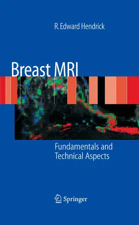 Hendrick | Breast MRI | E-Book | www.sack.de