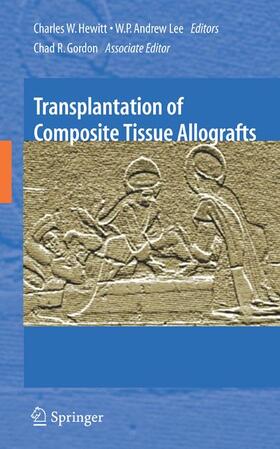 Hewitt / Lee | Transplantation of Composite Tissue Allografts | Buch | sack.de