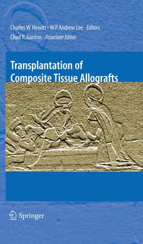 Hewitt / Lee / Gordon | Transplantation of Composite Tissue Allografts | E-Book | sack.de