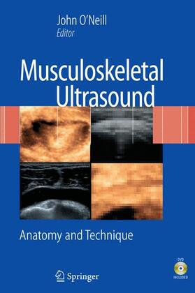 O'Neill |  Musculoskeletal Ultrasound | Sonstiges |  Sack Fachmedien