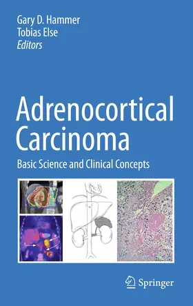 Hammer / Else |  Adrenocortical Carcinoma | Buch |  Sack Fachmedien