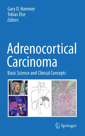 Else | Adrenocortical Carcinoma | E-Book | www.sack.de