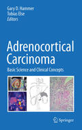 Hammer / Else |  Adrenocortical Carcinoma | eBook | Sack Fachmedien