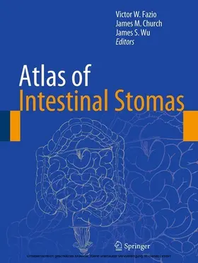 Fazio / Church / Wu |  Atlas of Intestinal Stomas | eBook | Sack Fachmedien