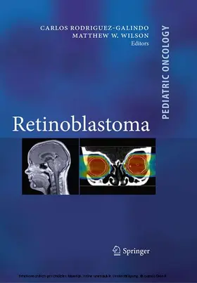 Rodriguez Galindo / Wilson / Chévez-Barrios |  Retinoblastoma | eBook | Sack Fachmedien