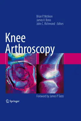 McKeon / Bono / Richmond |  Knee Arthroscopy | eBook | Sack Fachmedien