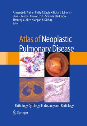 Fraire / Cagle / Irwin | Atlas of Neoplastic Pulmonary Disease | Buch | 978-0-387-89838-4 | sack.de