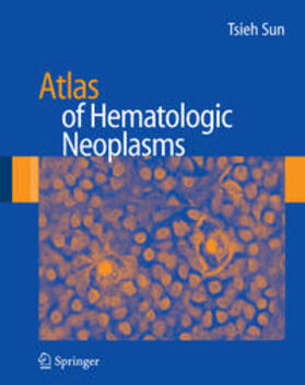 Sun |  Atlas of Hematologic Neoplasms | eBook | Sack Fachmedien