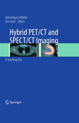 Delbeke / Israel |  Hybrid PET/CT and SPECT/CT Imaging | Buch |  Sack Fachmedien