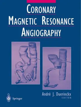 Duerinckx |  Coronary Magnetic Resonance Angiography | Buch |  Sack Fachmedien