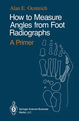 Oestreich |  How to Measure Angles from Foot Radiographs | Buch |  Sack Fachmedien