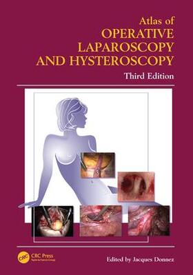 Donnez | Atlas of Operative Laparoscopy and Hysteroscopy | Buch | 978-0-415-38415-5 | sack.de