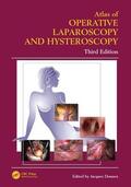 Donnez |  Atlas of Operative Laparoscopy and Hysteroscopy | Buch |  Sack Fachmedien