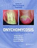 Baran / Hay / Haneke |  Onychomycosis | Buch |  Sack Fachmedien
