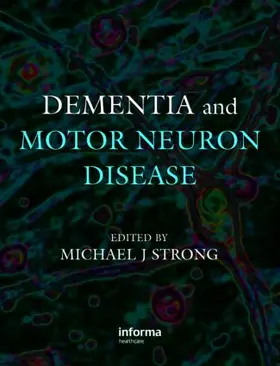 Strong |  Dementia and Motor Neuron Disease | Buch |  Sack Fachmedien