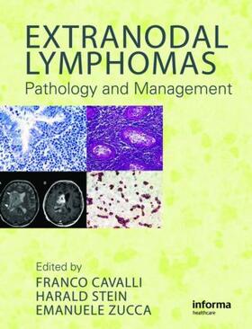 Cavalli / Stein / Zucca |  Extranodal Lymphomas | Buch |  Sack Fachmedien