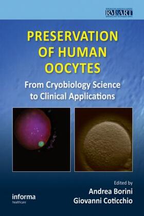 Borini / Coticchio | Preservation of Human Oocytes | Buch | 978-0-415-47679-9 | sack.de
