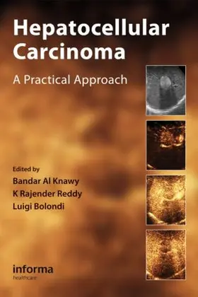 Al Knawy / Reddy / Bolondi | Hepatocellular Carcinoma | Buch | 978-0-415-48080-2 | www.sack.de