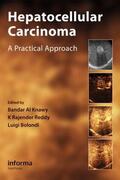 Knawy / Al Knawy / Reddy |  Hepatocellular Carcinoma | Buch |  Sack Fachmedien