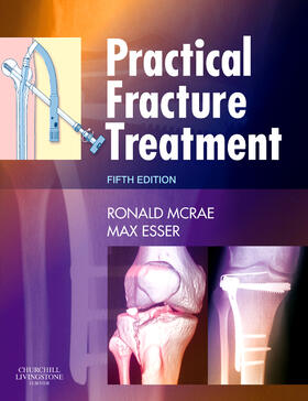 Esser / McRae | Practical Fracture Treatment | Buch | sack.de